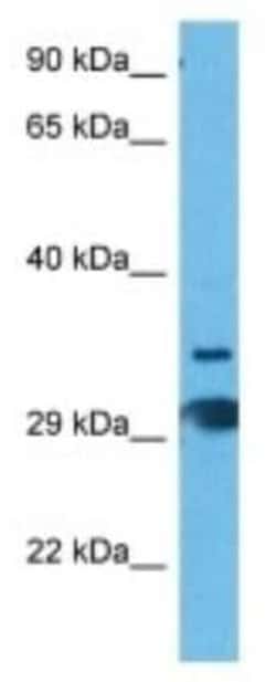 T2R60 Rabbit anti-Mouse, Polyclonal, Novus Biologicals 100 &mu;g; Unconjugated:Antibodies,